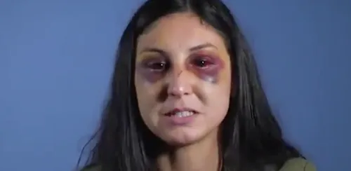 Val-de-Marne : elle accuse des policiers de l'avoir tabassée (vidéo)