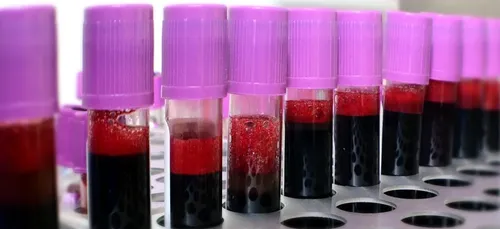 Opéra de Paris : des donneurs plutôt que des danseurs