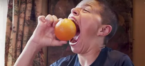 Cet enfant de 14 ans a la plus grande bouche du monde (Vidéo)