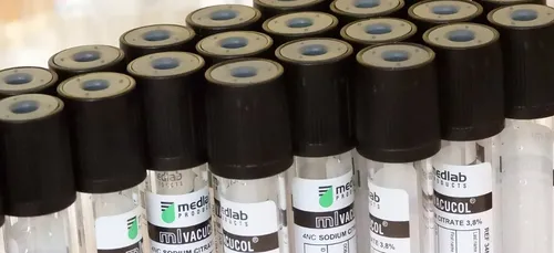 Contrôlé ivre au volant, il vole ses prélèvements sanguins pour ne...