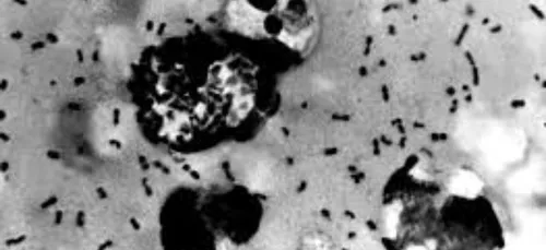Chine : après le Covid-19, vers une épidémie de peste bubonique?