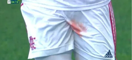 Un joueur de football coupé aux testicules en plein match (vidéo)