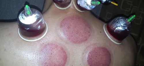 Rosny-sous-Bois : un couple arrêté pour avoir pratiqué des «...