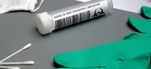 Covid : 5 centres de dépistages avec tests antigéniques dès cette...