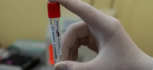 Colombes : sixième cas de variant sud-africain, seconde campagne de...