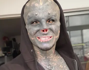 Après les oreilles et le nez, le Français "Black Alien" se fait...