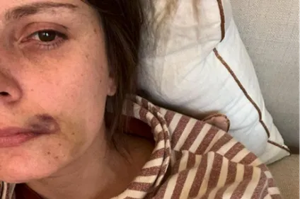 Une maman agressée avec son bébé à Paris : Darmanin réagit