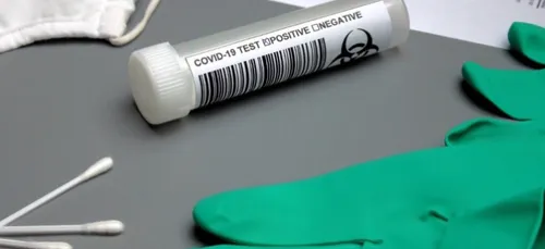 COVID : le variant "Henri Mondor" détecté à Meaux