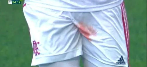 Un joueur de football coupé aux testicules en plein match (vidéo)