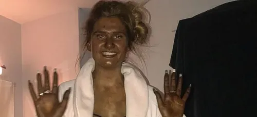 Une femme devient « verte » après avoir abusé de l'autobronzant !...