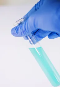 Nouvelle-Aquitaine : les laboratoires de biologie médicale en grève...