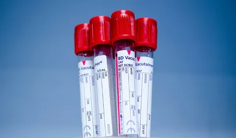 Nouvelle-Aquitaine : les collectes de sang continuent pendant les...