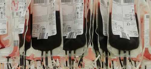 Nouvelle-Aquitaine : nouvel appel aux donneurs de sang