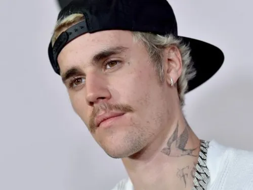 Justin Bieber souffre d'une paralysie du visage
