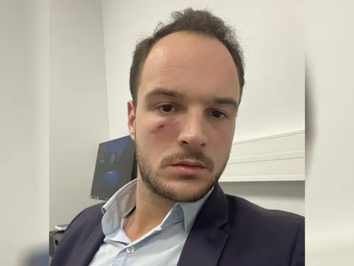 Abbeville : un conseiller départemental frappé au visage