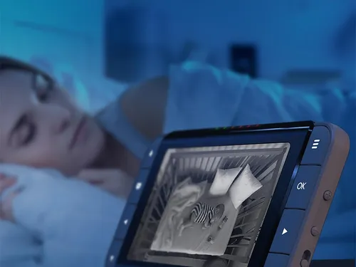 Des baby phones pour les Restos du Cœur de l’Essonne