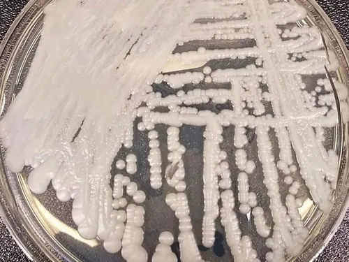 L’hôpital d’Amiens menacé par un champignon