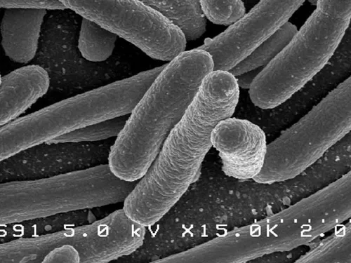 Intoxications alimentaires à Saint-Quentin : deux boucheries...