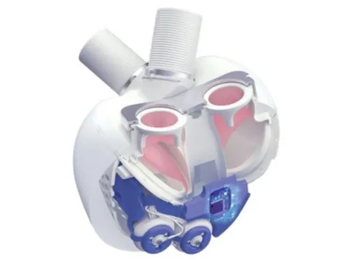 Les coeurs artificiels Carmat vont continuer de sauver des vies...