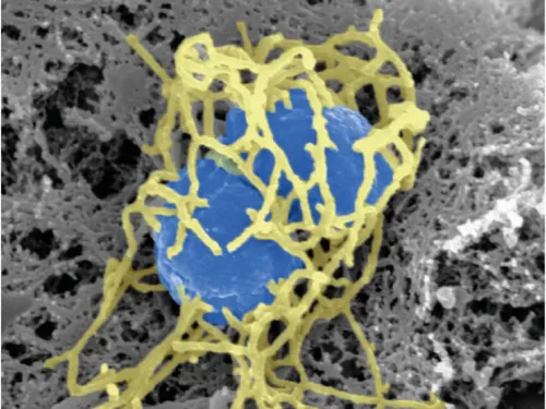 Quelques infections par méningocoques l'an dernier en Eure-et-Loir 