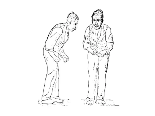 La maladie de Parkinson sévit toujours dans l'Oise 