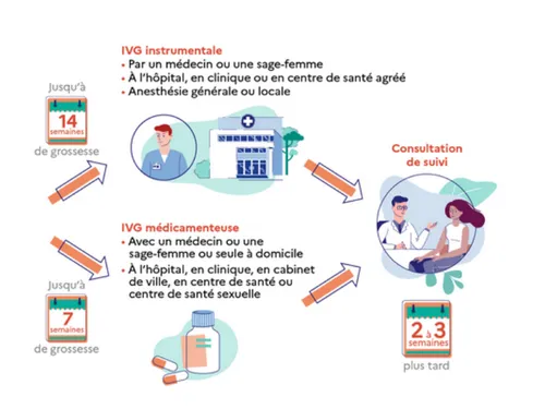 Le taux de recours à l'I.V.G. est moyen en Eure-et-Loir