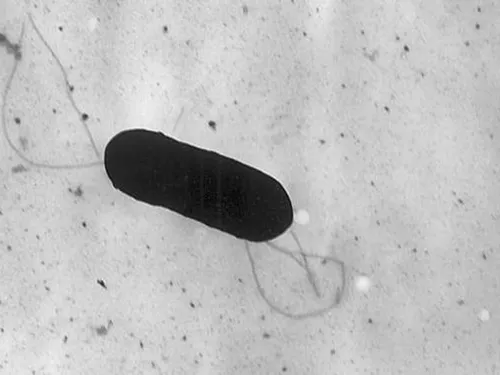 La listériose touche de plus en plus les habitants des Hauts-de-France