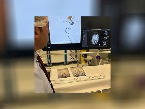 La prise en charge des AVC s'améliore à Mantes-la-Jolie