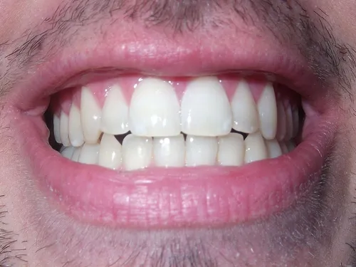 Très attendu, le centre bucco-dentaire du CHU d’Amiens ouvre lundi