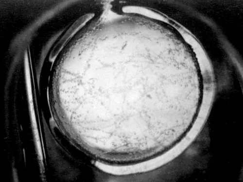 Hydrogène blanc : un combustible « du futur » présent en France 