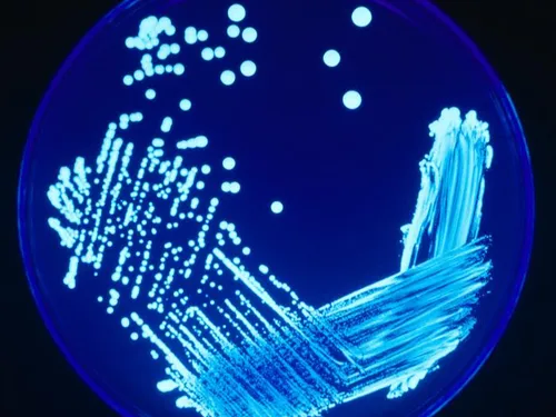 Une bactérie, la légionelle, menacerait 1.800 familles du Pays de...