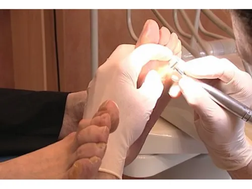 Le nombre de podologues progresse à pas réguliers en Eure-et-Loir