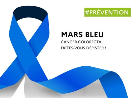 Des milliers de nouveaux cas de cancer colorectal détectés chaque...