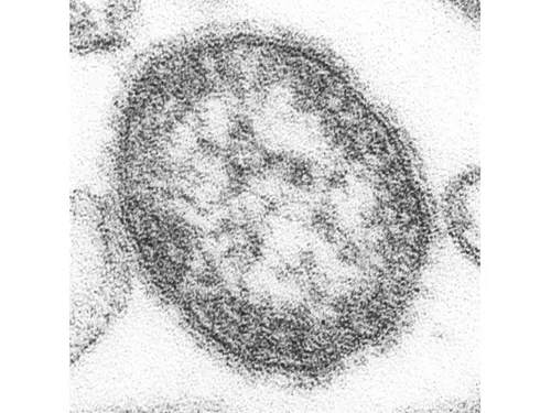 Les Euréliens épargnés par la rougeole