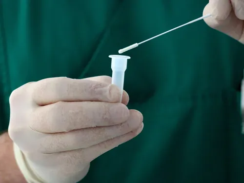 Covid-19 : un homme confiné pendant 14 mois après 78 tests positifs !