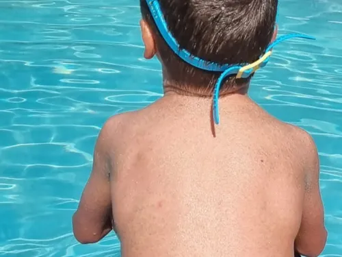 Le Chambon-Feugerolles : Privé de piscine à cause de sa maladie, le...