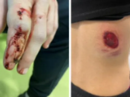 ASSE : les Green Angels dénoncent des violences policières à Dunkerque