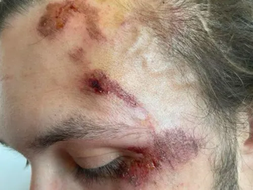 Appel à témoins à Boulogne-sur-Mer : Thomas, percuté violemment par...