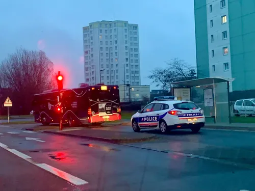 Calais : un homme brûlé au visage après une agression