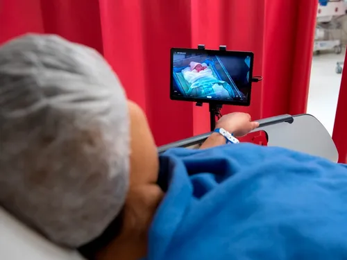 Césarienne. Au CHU d’Angers, des Babycam pour améliorer le vécu des...