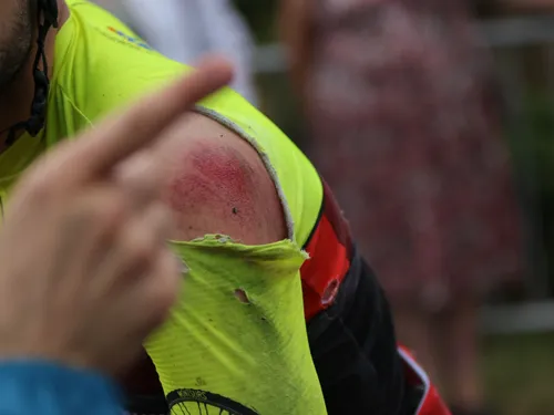 Pommerieux : en pleine course cycliste, une partie du peloton chute...