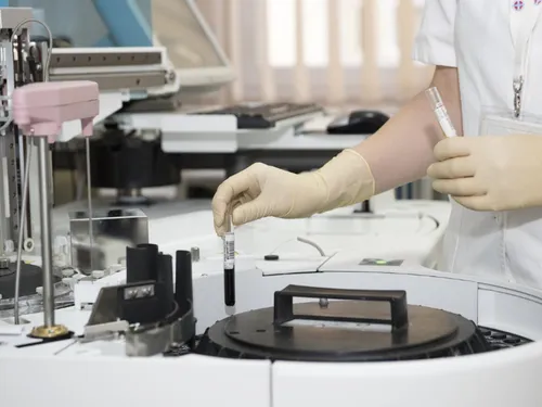 Mars Bleu : l'ARS lance un appel au dépistage dans la région