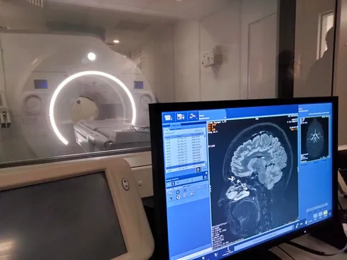 Hôpital de Montauban : une IRM dotée d'intelligence artificielle