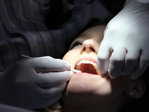 Soins dentaires : les patients bientôt moins remboursés