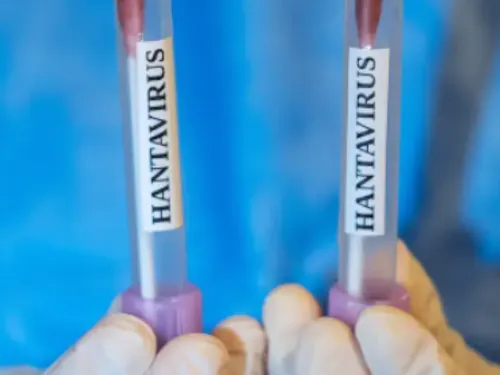 Hantavirus : les 26 cas contacts français sans symptôme, mais...