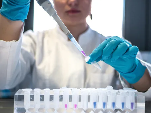 Les salariés des laboratoires de biologie médicale sont en grève ce...