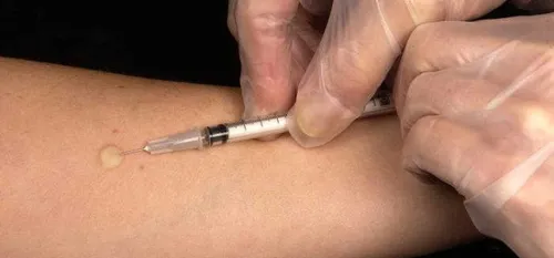 Recevoir l’injection contre la grippe directement en pharmacie,...