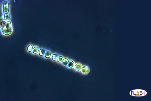 Une microalgue pour traiter les problèmes d’acné