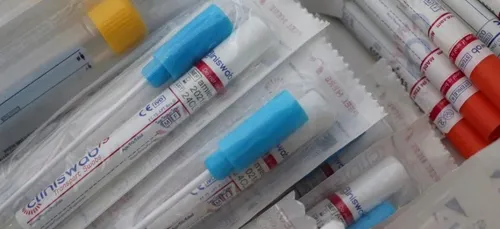 COVID-19 : 15 clusters en cours d’investigation en Pays de la Loire