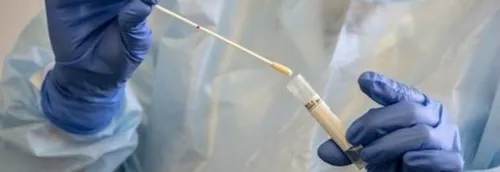 Le CHU de Lille prêt pour les tests de dépistages